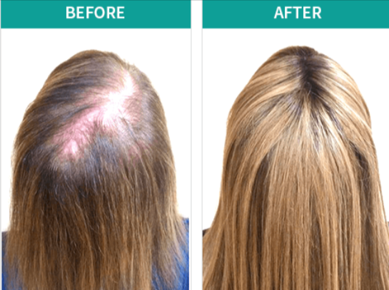 Benefits of BioGrow RX